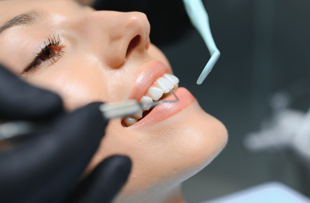 A close up of someone smiling as a dental assistant is about to clean their teeth